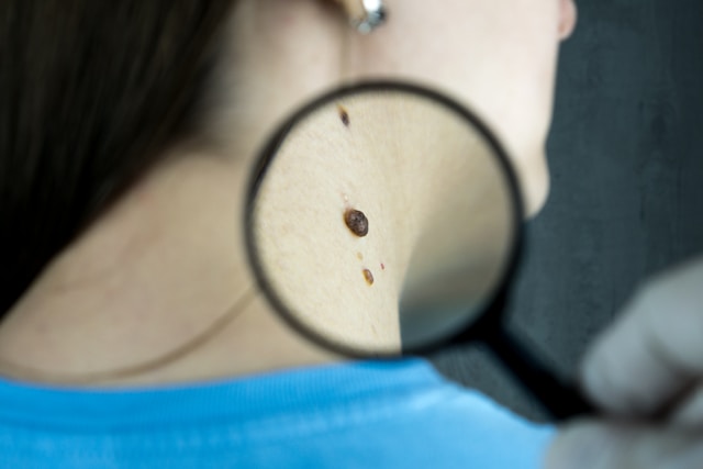 Marcar consulta com dermatologista online