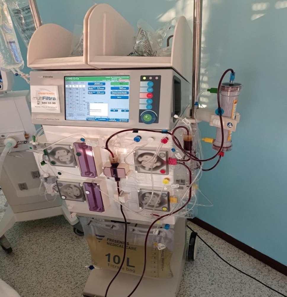 MULTIBIC SEM POTÁSSIO SOLUÇÃO PARA HEMODIÁLISE E HEMOFILTRAÇÃO